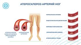 Что означает аббревиатура ПНО в контексте поддержки в Аптека Озерки